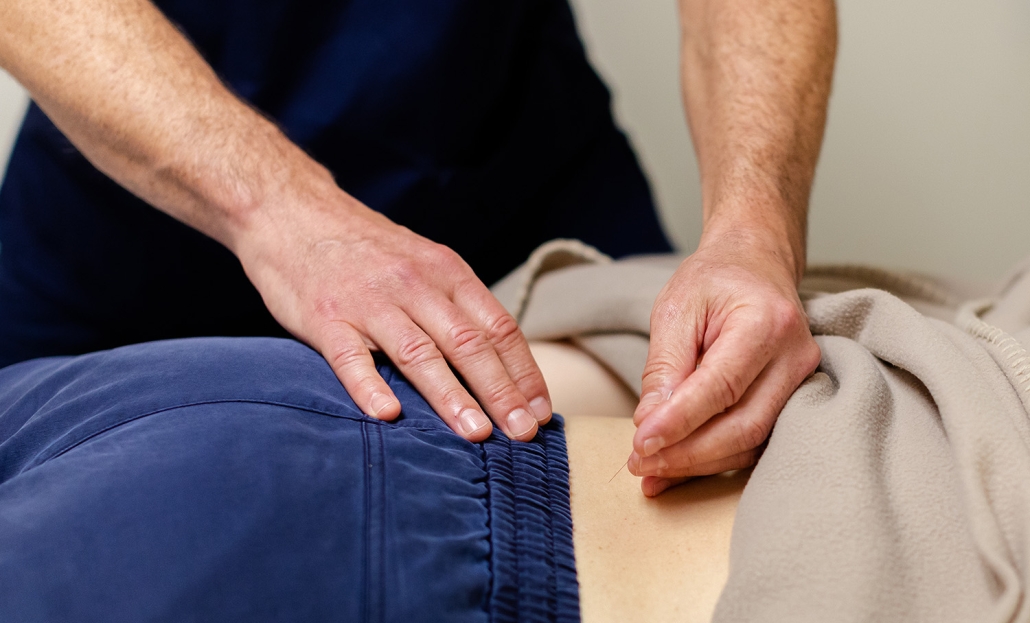 closeup of patient's back while receiving therapy at Shen Dao